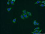 UAP1L1 Antibody in Immunocytochemistry (ICC/IF)