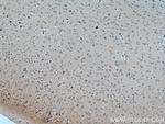 CRHR2 Antibody in Immunohistochemistry (Paraffin) (IHC (P))