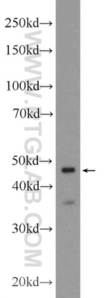 CRHR2 Antibody in Western Blot (WB)