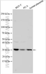 ORP1L Antibody in Western Blot (WB)