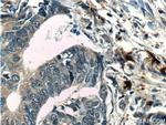 PRTN3 Antibody in Immunohistochemistry (Paraffin) (IHC (P))