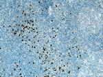 PRTN3 Antibody in Immunohistochemistry (Paraffin) (IHC (P))