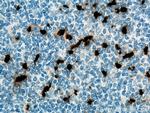 PRTN3 Antibody in Immunohistochemistry (Paraffin) (IHC (P))