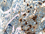 PRTN3 Antibody in Immunohistochemistry (Paraffin) (IHC (P))