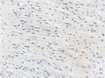 PRTN3 Antibody in Immunohistochemistry (Paraffin) (IHC (P))