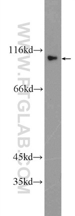 ACDP1 Antibody in Western Blot (WB)