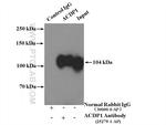 ACDP1 Antibody in Immunoprecipitation (IP)