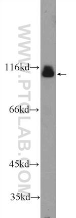ACDP1 Antibody in Western Blot (WB)