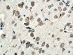 BEX5 Antibody in Immunohistochemistry (Paraffin) (IHC (P))