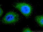 TRAPPC2L Antibody in Immunocytochemistry (ICC/IF)