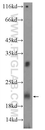TRAPPC2L Antibody in Western Blot (WB)