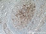 CD38 Antibody in Immunohistochemistry (Paraffin) (IHC (P))