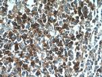CD38 Antibody in Immunohistochemistry (Paraffin) (IHC (P))