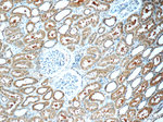 FER Antibody in Immunohistochemistry (Paraffin) (IHC (P))