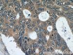 FER Antibody in Immunohistochemistry (Paraffin) (IHC (P))