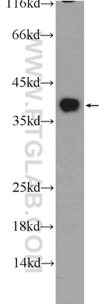EXOSC7 Antibody in Western Blot (WB)