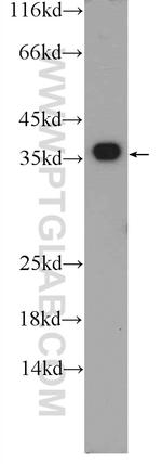 EXOSC7 Antibody in Western Blot (WB)