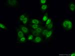 CWC15 Antibody in Immunocytochemistry (ICC/IF)
