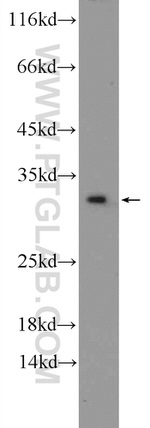 CWC15 Antibody in Western Blot (WB)