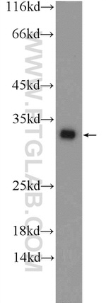 CWC15 Antibody in Western Blot (WB)