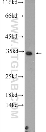 CWC15 Antibody in Western Blot (WB)