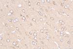PPFIA4 Antibody in Immunohistochemistry (Paraffin) (IHC (P))