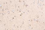 PPFIA4 Antibody in Immunohistochemistry (Paraffin) (IHC (P))