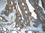 Claudin 23 Antibody in Immunohistochemistry (Paraffin) (IHC (P))
