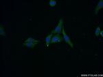 ZNF460 Antibody in Immunocytochemistry (ICC/IF)