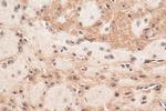 ZNF460 Antibody in Immunohistochemistry (Paraffin) (IHC (P))