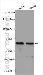 ZNF460 Antibody in Western Blot (WB)