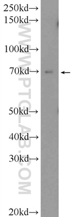ZNF460 Antibody in Western Blot (WB)
