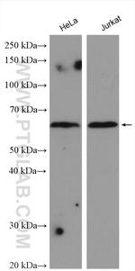 ZNF460 Antibody in Western Blot (WB)