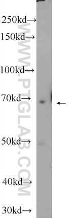ZNF460 Antibody in Western Blot (WB)
