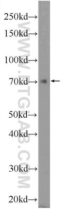 ZNF460 Antibody in Western Blot (WB)