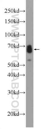 ASB14 Antibody in Western Blot (WB)
