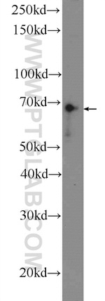 ASB14 Antibody in Western Blot (WB)