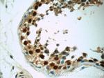 ZNF571 Antibody in Immunohistochemistry (Paraffin) (IHC (P))