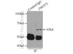 ZNF571 Antibody in Immunoprecipitation (IP)
