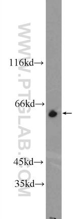 ZNF571 Antibody in Western Blot (WB)