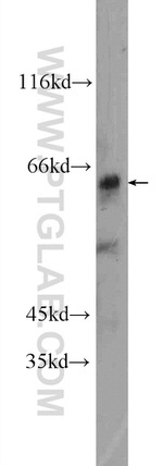 ZNF571 Antibody in Western Blot (WB)