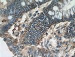 DTX3 Antibody in Immunohistochemistry (Paraffin) (IHC (P))