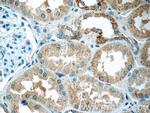 DTX3 Antibody in Immunohistochemistry (Paraffin) (IHC (P))