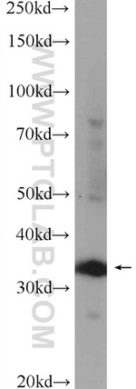 DTX3 Antibody in Western Blot (WB)
