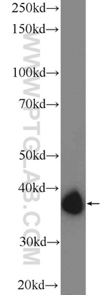 DTX3 Antibody in Western Blot (WB)