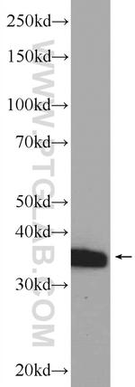 DTX3 Antibody in Western Blot (WB)