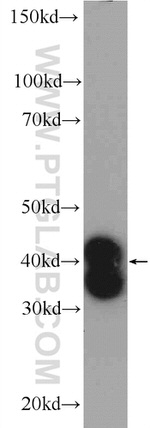 DTX3 Antibody in Western Blot (WB)