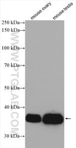 DTX3 Antibody in Western Blot (WB)