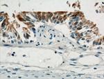 PIH1D3 Antibody in Immunohistochemistry (Paraffin) (IHC (P))