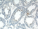 PIH1D3 Antibody in Immunohistochemistry (Paraffin) (IHC (P))
